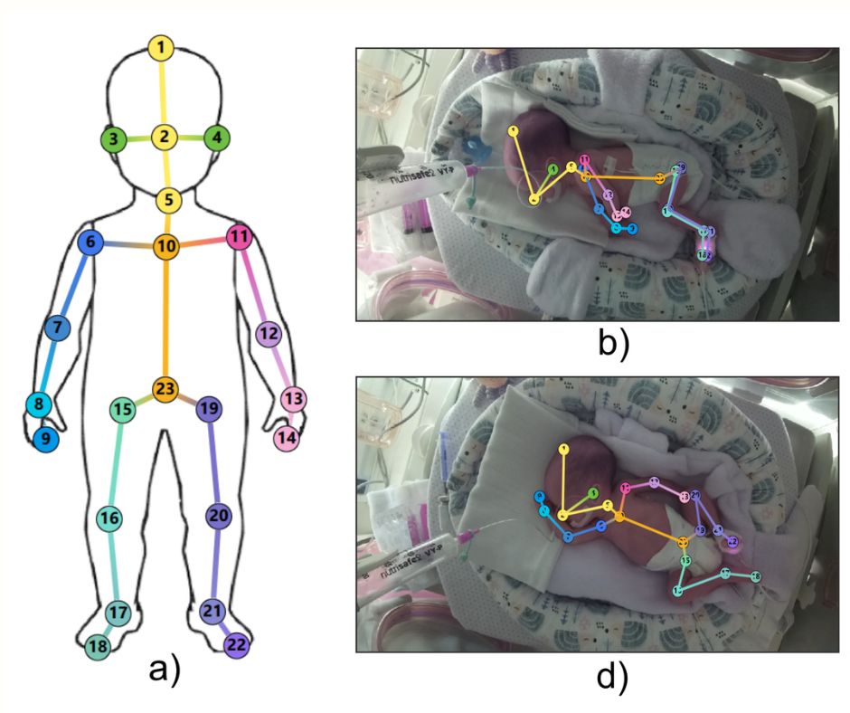International publication highlights AI-assisted neonatal care